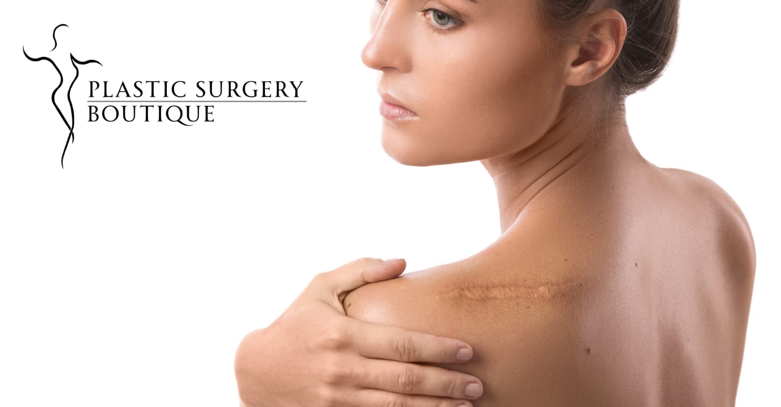 Scar revision surgery in Miami: Transform your confidence with Dr. Sophie, a double board-certified plastic surgeon